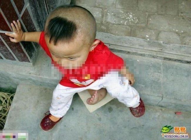 Chinese_doctors_remove_babys_third_arm_1.jpg