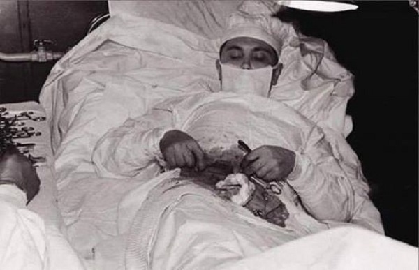 Leonid Rogozov, surgery to remove the appendicitis itself. 1961.jpg